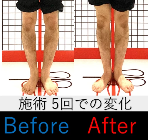 お客様の体験談