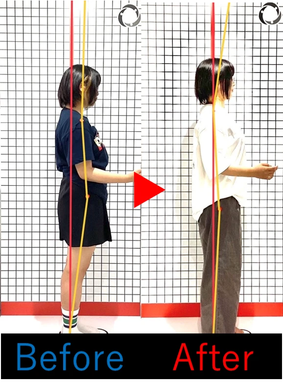 2. 骨盤矯正の効果